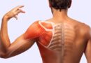 L’arthroscopie de l’épaule : Tout ce que vous devez savoir‍